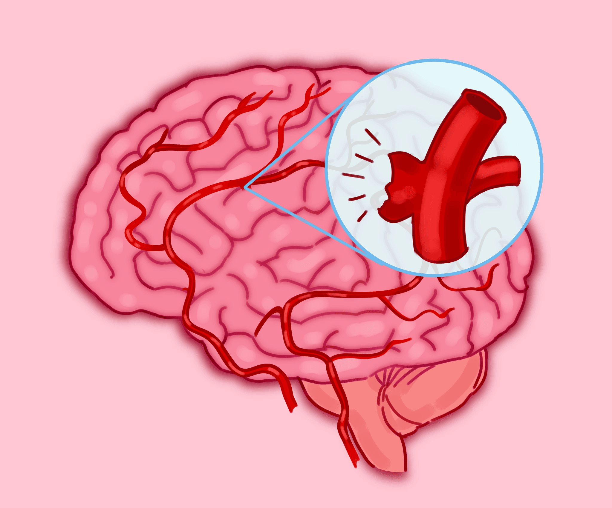 Feature image